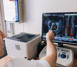 Врач рентгенэндоваскулярных методов диагностики и лечения Станислав Сапожников показывает работу визуализирующих методик