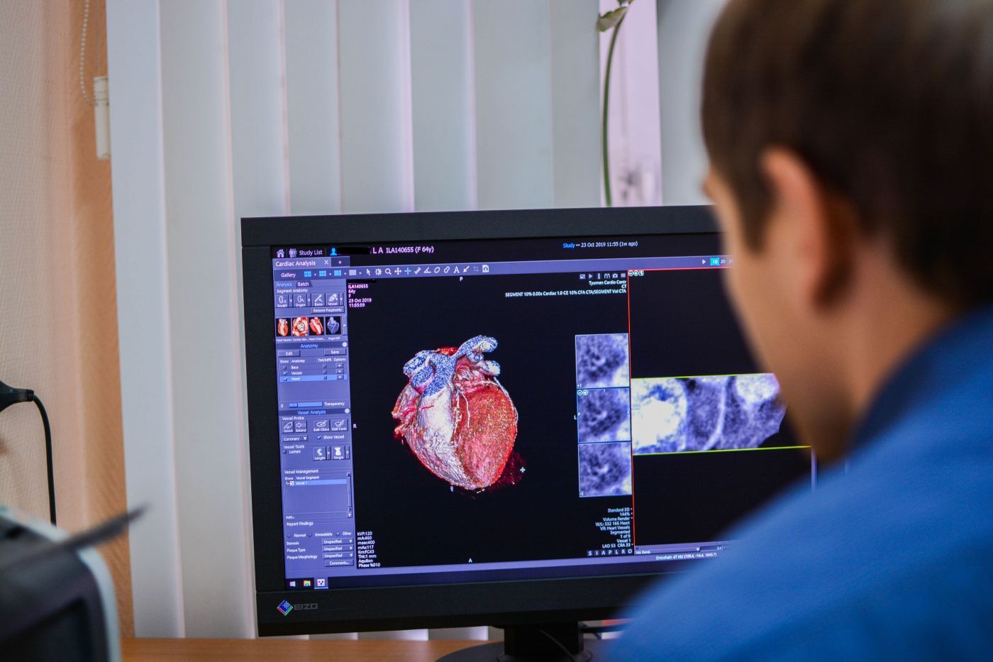 Computed tomography for children and adults 