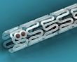The first bioresorbable stent will be implanted in Tyumen Cardiology Center